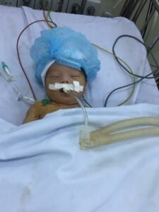 Bé Phùng Khánh An - 4 ngày tuổi chẩn đoán bị tim bẩm sinh